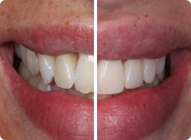 Before and after: 
