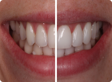 Before and after: 