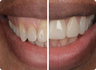 Before and after: 