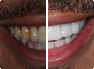 Before and after: 