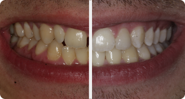 Before and after: 