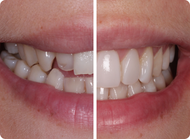 Before and after: 