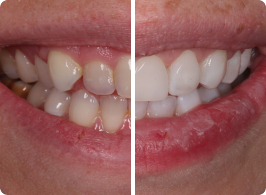 Before and after: 
