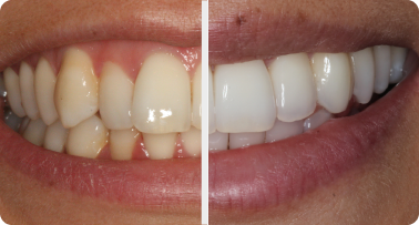 Before and after: 